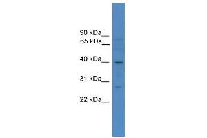 Image no. 1 for anti-SRY (Sex Determining Region Y)-Box 1 (SOX1) (N-Term) antibody (ABIN2780734)