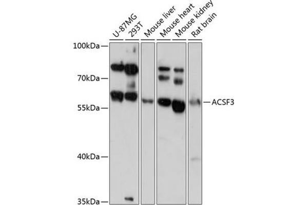ACSF3 antibody  (AA 270-450)