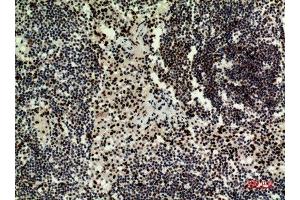 Image no. 2 for anti-Hepatoma-Derived Growth Factor-Related Protein 3 (HDGFRP3) (Internal Region) antibody (ABIN3187976)