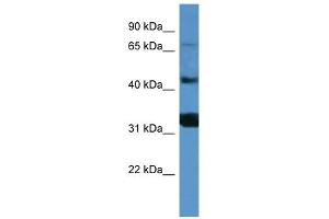 Image no. 1 for anti-Antigen P97 (Melanoma Associated) Identified By Monoclonal Antibodies 133.2 and 96.5 (MFI2) (C-Term) antibody (ABIN2774284)