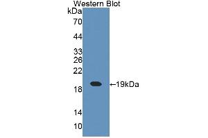 CRABP1 antibody  (AA 2-137)
