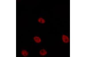 Image no. 1 for anti-Transcription Elongation Factor A (SII)-Like 6 (TCEAL6) antibody (ABIN6258710)