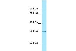 Image no. 1 for anti-Caudal Type Homeobox 2 (CDX2) (Middle Region) antibody (ABIN2777319)