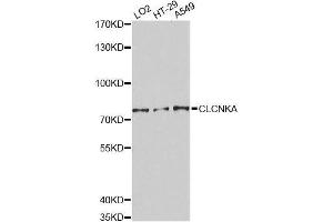 Image no. 1 for anti-Chloride Channel Ka (CLCNKA) antibody (ABIN1679253)