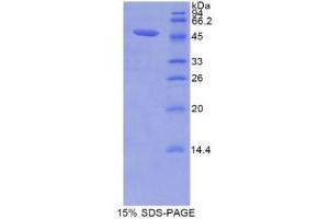 Image no. 1 for Lipocalin 12 (LCN12) (AA 30-193) protein (His tag,GST tag) (ABIN1877609)