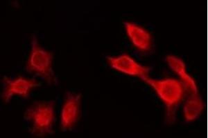 Image no. 1 for anti-Src Homology 2 Domain Containing Transforming Protein D (SHD) (Internal Region) antibody (ABIN6258726)