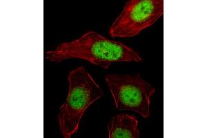 Image no. 2 for anti-Purine-Rich Element Binding Protein B (PURB) (C-Term) antibody (ABIN2495955)