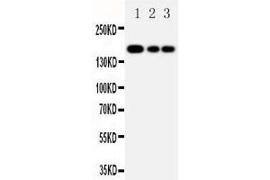 Image no. 2 for anti-ATP-Binding Cassette, Sub-Family C (CFTR/MRP), Member 1 (ABCC1) (AA 1514-1531), (C-Term) antibody (ABIN3044230)