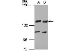 Image no. 4 for anti-Ubiquitin Specific Peptidase 8 (USP8) (Center) antibody (ABIN2855692)