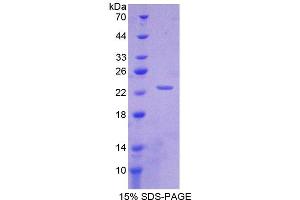 Image no. 1 for Interleukin 1 alpha (IL1A) (AA 101-270) protein (His tag) (ABIN6237678)