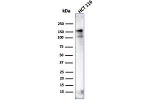 MSH6 Antikörper  (AA 374-540)
