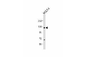 Image no. 2 for anti-Ubiquitin Specific Peptidase 15 (USP15) (AA 151-180), (N-Term) antibody (ABIN388904)