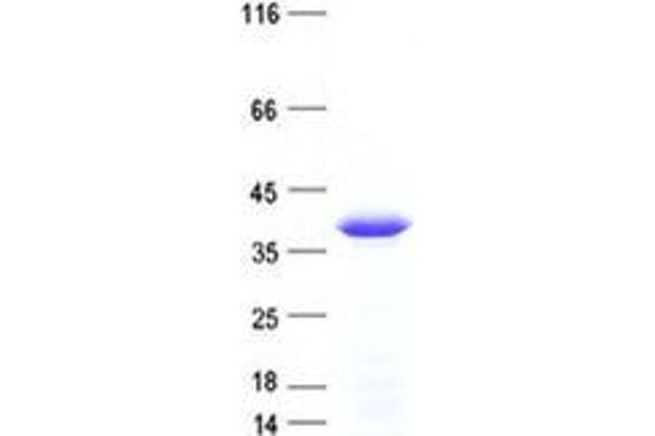 Williams Beuren Syndrome Chromosome Region 22 (WBSCR22) protein (His tag)