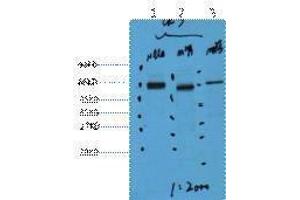 Image no. 1 for anti-Keratin 7 (KRT7) antibody (ABIN3181124)