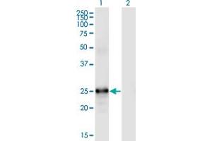 Western Blot analysis of FGF19 expression in transfected 293T cell line by FGF19 monoclonal antibody (M01), clone 4C4.