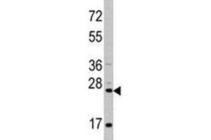 Image no. 5 for anti-CD8a Molecule (CD8A) (AA 59-88) antibody (ABIN3028555)
