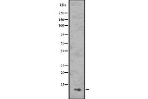Image no. 1 for anti-PYD (Pyrin Domain) Containing 1 (PYDC1) antibody (ABIN6260072)