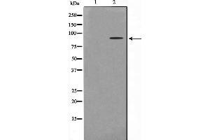Image no. 4 for anti-Heterogeneous Nuclear Ribonucleoprotein M (HNRNPM) antibody (ABIN6262325)