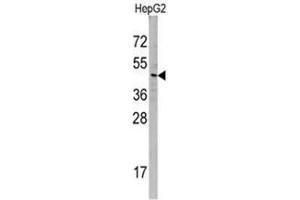 Image no. 1 for anti-Sorting Nexin 6 (SNX6) (N-Term) antibody (ABIN356971)