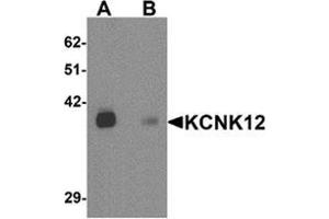 Image no. 1 for anti-Potassium Channel, Subfamily K, Member 12 (KCNK12) (C-Term) antibody (ABIN1450041)