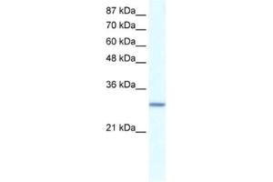 Image no. 1 for anti-General Transcription Factor IIE, Polypeptide 2 (GTF2E2) antibody (ABIN2460220)