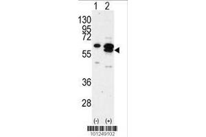 Image no. 2 for anti-Calcium/calmodulin-Dependent Protein Kinase IG (CAMK1G) (AA 420-450), (C-Term) antibody (ABIN391376)