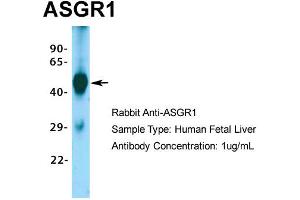 Image no. 2 for anti-Asialoglycoprotein Receptor 1 (ASGR1) (Middle Region) antibody (ABIN2778131)