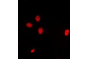Image no. 2 for anti-Inhibitor of Growth Family, Member 3 (ING3) (full length) antibody (ABIN6043600)