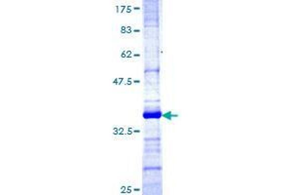 TRIM35 Protein (AA 394-493) (GST tag)