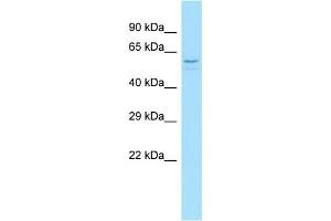 Image no. 1 for anti-Protein Disulfide Isomerase-Like, Testis Expressed (PDILT) (C-Term) antibody (ABIN2790840)