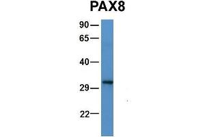 Image no. 3 for anti-Paired Box 5 (PAX5) (N-Term) antibody (ABIN2775953)