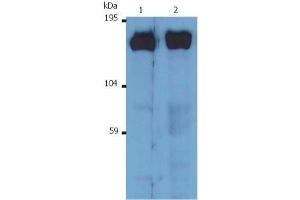 Image no. 1 for anti-Son of Sevenless Homolog 1 (SOS1) antibody (ABIN2476553)