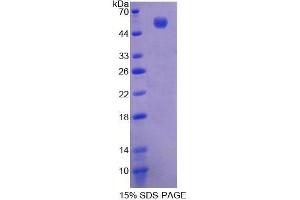 Image no. 1 for Lysophosphatidylcholine Acyltransferase 1 (LPCAT1) (AA 301-514) protein (His tag,GST tag) (ABIN6237496)