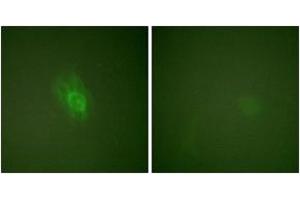 Immunofluorescence analysis of HeLa cells treated with TNF-a 20nM 15', using IkappaB-beta (Phospho-Ser23) Antibody.