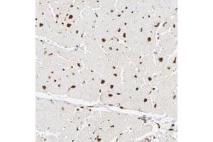 Image no. 3 for anti-Nuclear Factor I/B (NFIB) antibody (ABIN5584434)