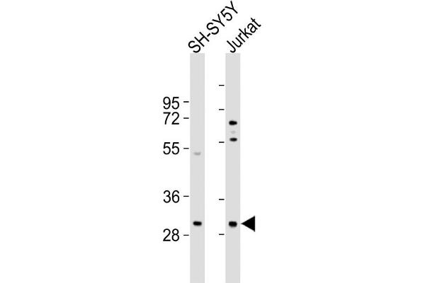 TRMT61A 抗体  (N-Term)