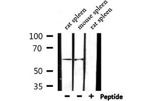 Image no. 3 for anti-Cytochrome P450, Family 2, Subfamily D, Polypeptide 6 (CYP2D6) antibody (ABIN6258047)