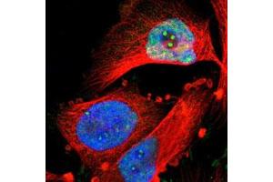 Image no. 1 for anti-Nuclear Factor I/B (NFIB) antibody (ABIN5584434)