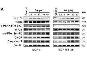 Image no. 6 for anti-Eukaryotic Translation Initiation Factor 2A, 65kDa (EIF2A) (pSer51) antibody (ABIN6255389)