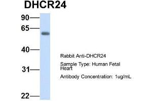 Image no. 1 for anti-24-Dehydrocholesterol Reductase (DHCR24) (N-Term) antibody (ABIN2782831)
