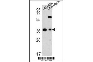 Western Blotting (WB) image for anti-Fumarylacetoacetate Hydrolase Domain Containing 2A (FAHD2A) antibody (ABIN2161093)