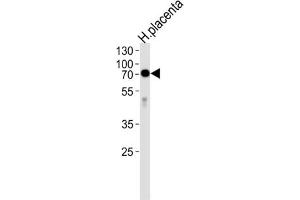 Image no. 2 for anti-Alkaline Phosphatase (ALP) antibody (ABIN2998256)