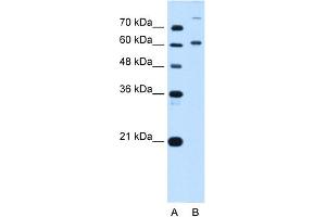 WB Suggested Anti-BMP2K Antibody Titration:  5.