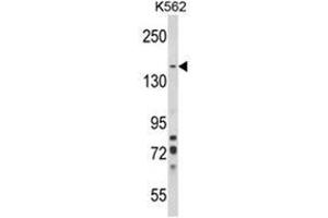 Western blot analysis of SORCS1 Antibody (N-term) in K562 cell line lysates (35ug/lane).