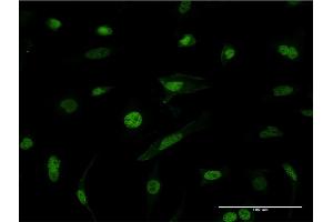 Image no. 2 for anti-Heterogeneous Nuclear Ribonucleoprotein M (HNRNPM) (AA 17-112) antibody (ABIN518183)