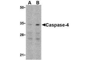 Image no. 3 for anti-Caspase 4, Apoptosis-Related Cysteine Peptidase (CASP4) (N-Term) antibody (ABIN499561)