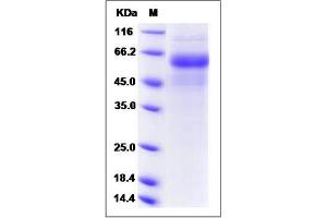 Image no. 1 for Discoidin Domain Receptor tyrosine Kinase 2 (DDR2) (AA 1-399) protein (His tag) (ABIN2009515)