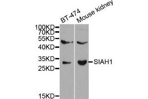 Image no. 2 for anti-E3 Ubiquitin-Protein Ligase SIAH1 (SIAH1) antibody (ABIN3016132)