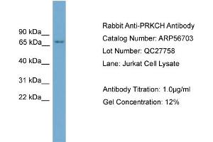 Image no. 2 for anti-Protein Kinase C, eta (PRKCH) (N-Term) antibody (ABIN2786852)