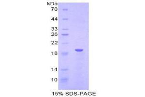 Image no. 1 for Lysophosphatidylcholine Acyltransferase 3 (LPCAT3) protein (ABIN1170894)
